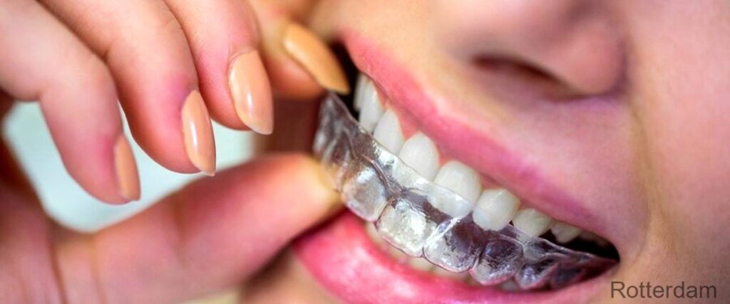 De 7 beste orthodontisten in Rotterdam